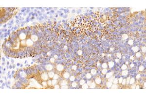 Immunohistochemistry (IHC) image for anti-Keratin 13 (KRT13) (AA 104-403) antibody (ABIN7434251)