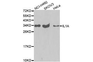 Western blot analysis of extracts of various cell lines, using IL1A antibody. (IL1A 抗体  (AA 112-271))