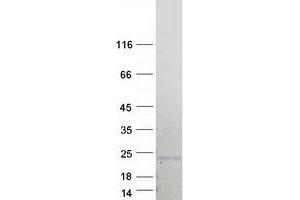 Western Blotting (WB) image for B-Cell CLL/lymphoma 7B (BCL7B) (Transcript Variant 2) protein (Myc-DYKDDDDK Tag) (ABIN2715208)