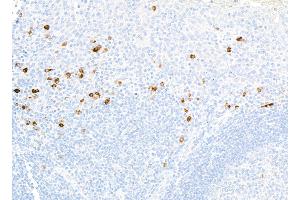 Immunohistochemistry (IHC) image for anti-CD80 (CD80) (AA 35-246) antibody (ABIN7449415) (Recombinant CD80 抗体  (AA 35-246))
