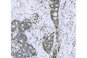 IHC analysis of CSNK2B using anti-CSNK2B antibody (ABIN7599092). (CSNK2B 抗体  (AA 1-215))