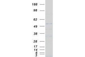 Western Blotting (WB) image for Natural Cytotoxicity Triggering Receptor 2 (NCR2) protein (Myc-DYKDDDDK Tag) (ABIN2713676)