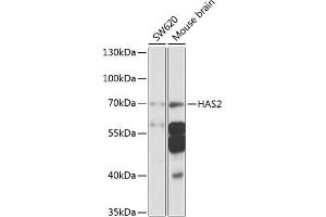 Western blot analysis of extracts of various cell lines, using H antibody (ABIN6129690, ABIN6141613, ABIN6141614 and ABIN6225245) at 1:1000 dilution. (HAS2 抗体  (AA 67-185))