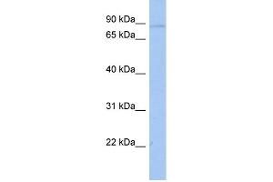 WB Suggested Anti-ATXN7L2 Antibody Titration: 0. (ATXN7L2 抗体  (Middle Region))