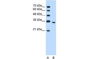 WB Suggested Anti-PRPS2 Antibody Titration:  1. (PRPS2 抗体  (N-Term))