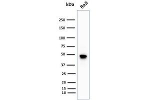 Western Blot Analysis of human Raji cell lysate using CD79a Rabbit Recombinant Monoclonal Antibody (IGA/1688R). (Recombinant CD79a 抗体  (AA 202-216))