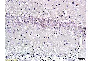 Formalin-fixed and paraffin embedded rat brain labeled with Anti-Nociceptin Polyclonal Antibody, Unconjugated (ABIN724535) 1:300 followed by conjugation to the secondary antibody and DAB staining (Nociceptin 抗体  (AA 130-146))