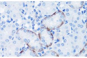 Immunohistochemistry of paraffin-embedded Mouse kidney using Phospho-P70 S6K(T389) Polyclonal Antibody at dilution of 1:100 (40x lens). (RPS6KB1 抗体  (pThr389))