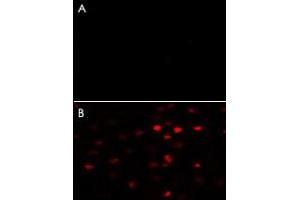 A : Negative control of HeLa cells without Alexa-Fluor-546-conjugated donkey anti-rabbit lgG (H+L). (PKM2 抗体  (AA 483-513))