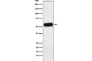 Western blot analysis of Fetuin A expression in Human plasma lysate.