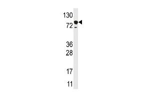 Western blot analysis of anti-EPS15 Pab (ABIN388933 and ABIN2839202) in HL60 cell line lysate (35 μg/lane).