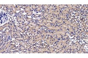 Detection of MAP2K7 in Mouse Kidney Tissue using Polyclonal Antibody to Mitogen Activated Protein Kinase Kinase 7 (MAP2K7) (MAP2K7 抗体  (AA 113-388))