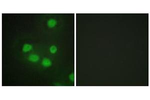 Immunofluorescence analysis of HepG2 cells, using SIX6 antibody. (SIX Homeobox 6 抗体  (Internal Region))