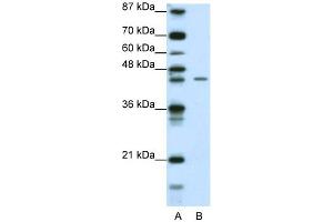 WB Suggested Anti-ZNF17 Antibody Titration: 0. (ZNF17 抗体  (N-Term))