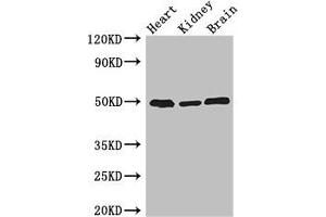 Western Blot Positive WB detected in: Mouse heart tissue, Mouse kidney tissue, Mouse brain tissue All lanes: ANKRD10 antibody at 4 μg/mL Secondary Goat polyclonal to rabbit IgG at 1/50000 dilution Predicted band size: 45, 24 kDa Observed band size: 50 kDa (ANKRD1 抗体  (AA 1-220))