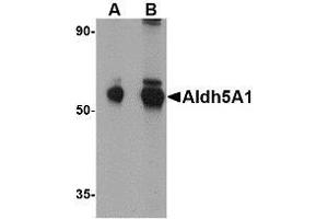 Western blot analysis of Aldh5A1 in mouse liver lysate with AP30045PU-N Aldh5A1 antibody at (A) 1 and (B) 2 μg/ml. (ALDH5A1 抗体  (C-Term))