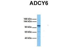 Host:  Rabbit  Target Name:  ADCY6  Sample Tissue:  Human Fetal Kidney  Antibody Dilution:  1. (ADCY6 抗体  (C-Term))