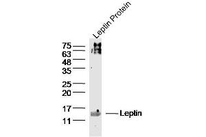 Leptin lysates probed with Leptin Polyclonal Antibody, Unconjugated  at 1:300 dilution and 4˚C overnight incubation. (Leptin 抗体  (AA 17-100))