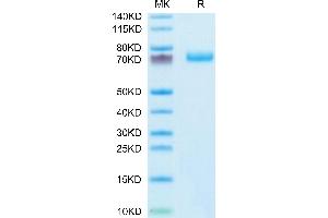 EPH Receptor A3 Protein (EPHA3) (AA 21-541) (His tag)