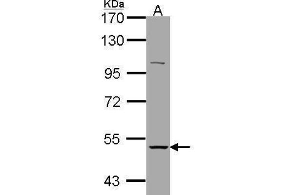 CHRNA3 抗体  (Center)