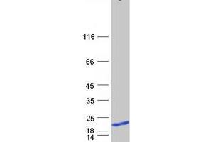 Validation with Western Blot