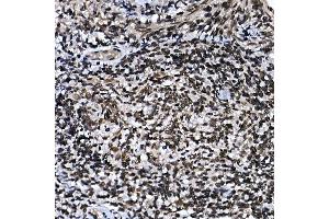 Immunohistochemistry (IHC) image for anti-Zinc Finger Protein 384 (ZNF384) (AA 1-180) antibody (ABIN7271478)
