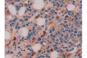Immunohistochemistry (IHC) image for anti-Interleukin 16 (IL16) (AA 1203-1332) antibody (ABIN7430693)