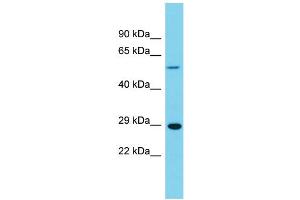 Host: Rabbit  Target Name: Uchl1  Sample Tissue: Rat Stomach lysates  Antibody Dilution: 1. (UCHL1 抗体  (Middle Region))