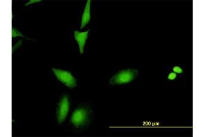 Immunofluorescence of monoclonal antibody to CRADD on HeLa cell. (CRADD 抗体  (AA 1-199))