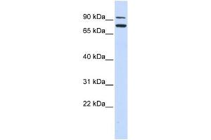WB Suggested Anti-ZNF440 Antibody Titration:  0. (ZNF440 抗体  (Middle Region))