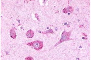 Immunohistochemical staining of human brain, neurons with LPHN3 polyclonal antibody . (LPHN3 抗体  (C-Term))