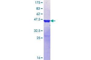 Image no. 1 for Protein Phosphatase 1, Regulatory Subunit 3A (PPP1R3A) (AA 3-101) protein (GST tag) (ABIN1315989) (PPP1R3A Protein (AA 3-101) (GST tag))