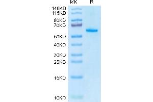 EPH Receptor A2 Protein (EPHA2) (AA 24-537) (His tag)