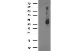 Western Blotting (WB) image for anti-Ganglioside-Induced Differentiation-Associated Protein 1-Like 1 (GDAP1L1) antibody (ABIN1498421) (GDAP1L1 抗体)