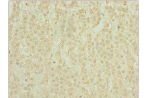 Immunohistochemistry of paraffin-embedded human adrenal gland tissue using ABIN7163721 at dilution of 1:100 (POC1A 抗体  (AA 138-407))