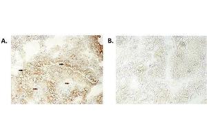 Immunohistochemical staining of bioptic sections of small intestine using anti-NLRP6/NALP6 (human), mAb (Clint-1)  at 1:500 dilution. (NLRP6 抗体)