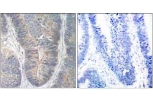 Immunohistochemistry (IHC) image for anti-Eukaryotic Translation Initiation Factor 2-alpha Kinase 2 (EIF2AK2) (AA 418-467), (pThr451) antibody (ABIN1531953)