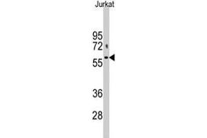 Western blot analysis of PFKFB1 polyclonal antibody  in Jurkat cell lysate (35 ug/lane). (PFKFB1 抗体  (N-Term))