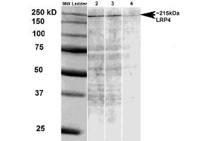 Western Blot analysis of Rat brain membrane lysate showing detection of LRP4 protein using Mouse Anti-LRP4 Monoclonal Antibody, Clone S207-27 . (LRP4 抗体  (AA 26-350) (Atto 390))