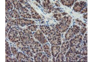 Image no. 3 for anti-Diphthamide Biosynthesis Protein 2 (DPH2) antibody (ABIN1497893) (DPH2 抗体)
