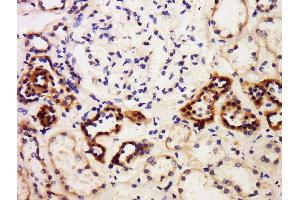 Formalin-fixed and paraffin embedded human kidney labeled with Anti-PBEF (CT) Polyclonal Antibody, Unconjugated  at 1:300 followed by conjugation to the secondary antibody and DAB staining. (NAMPT 抗体  (AA 401-491))