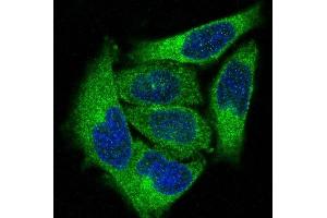 Immunofluorescent analysis of Hela cells, using PKC alpha Antibody . (Recombinant PKC alpha 抗体)