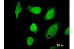 Immunofluorescence of purified MaxPab antibody to CAPN1 on HeLa cell. (CAPNL1 抗体  (AA 1-714))