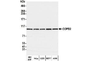 Western Blotting (WB) image for anti-Coatomer Protein Complex, Subunit beta 2 (COPB2) (AA 856-906) antibody (ABIN7453569) (COPB2 抗体  (AA 856-906))