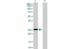 Western Blot analysis of RND3 expression in transfected 293T cell line by RND3 MaxPab polyclonal antibody. (RND3 抗体  (AA 1-244))