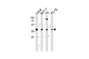 Western blot analysis of lysates from Jurkat, MCF-7, F9, PC-12 cell line (from left to right), using human-FOSL2 (Y83) (ABIN6243663 and ABIN6577541). (FOSL2 抗体  (AA 70-110))
