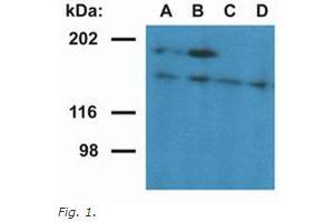 Western Blotting (WB) image for anti-Ubinuclein 1 (UBN1) (AA 1-190), (N-Term) antibody (ABIN614815) (Ubinuclein 1 抗体  (N-Term))