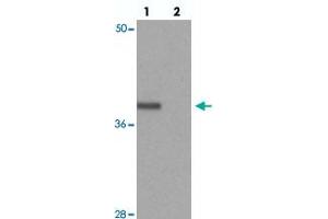 Western blot analysis of PRICKLE4 in A-549 cell lysate with PRICKLE4 polyclonal antibody  at 0. (PRICKLE4 抗体  (N-Term))