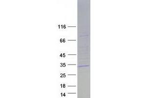 Western Blotting (WB) image for Steroidogenic Acute Regulatory Protein (STAR) (Transcript Variant 1) protein (Myc-DYKDDDDK Tag) (ABIN2732762)