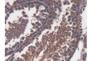 DAB staining on IHC-P; Samples: Mouse Testis Tissue (TLR1 抗体  (AA 25-134))